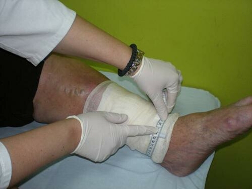 Fizikalna terapija se sprovodi individualno