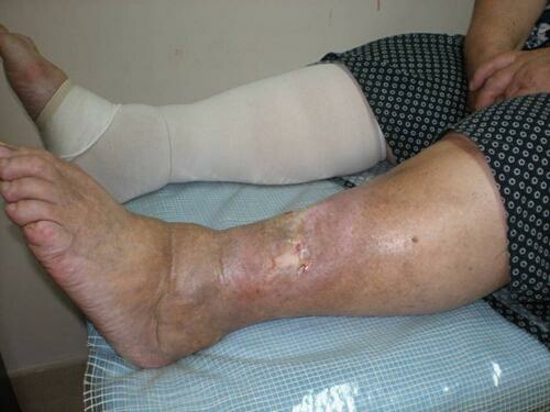 Quantum Resonance Magnetic Analyzer