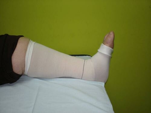 postavljanje kineziotaping traka